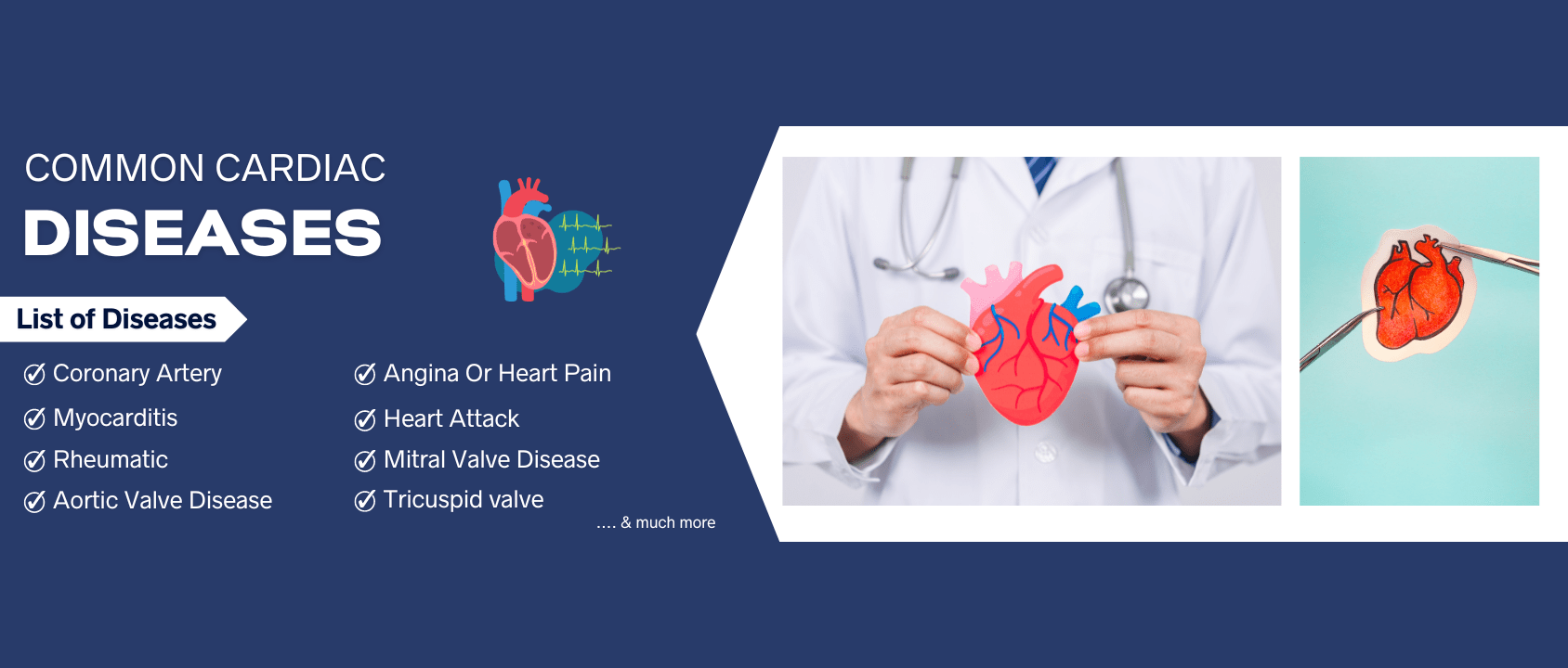 Common Cardiac Diseases