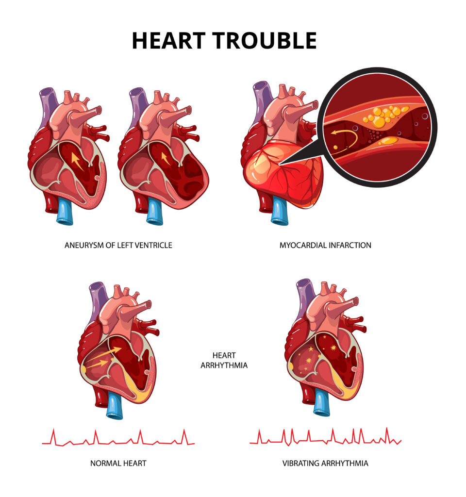 Cardiac Surgery