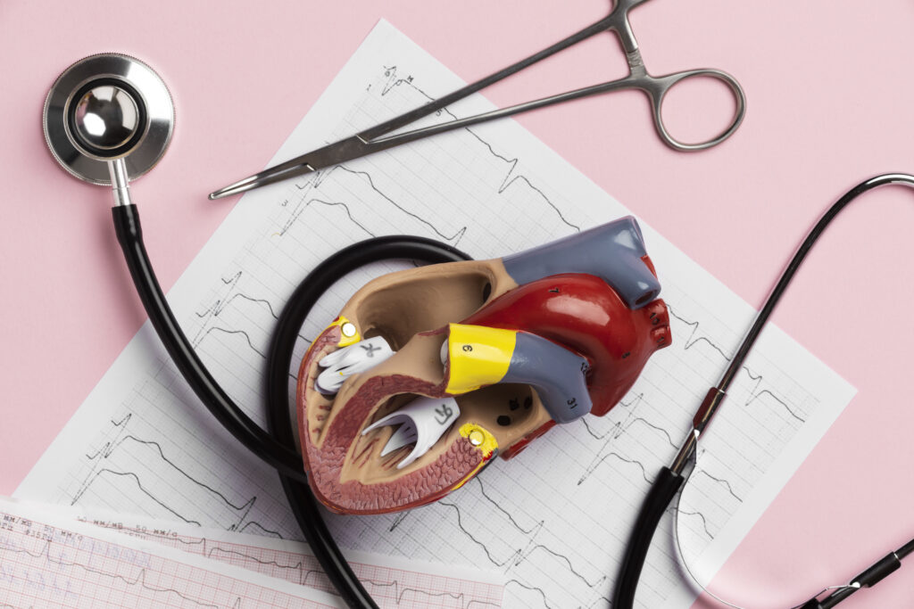 Aortic Aneurysm