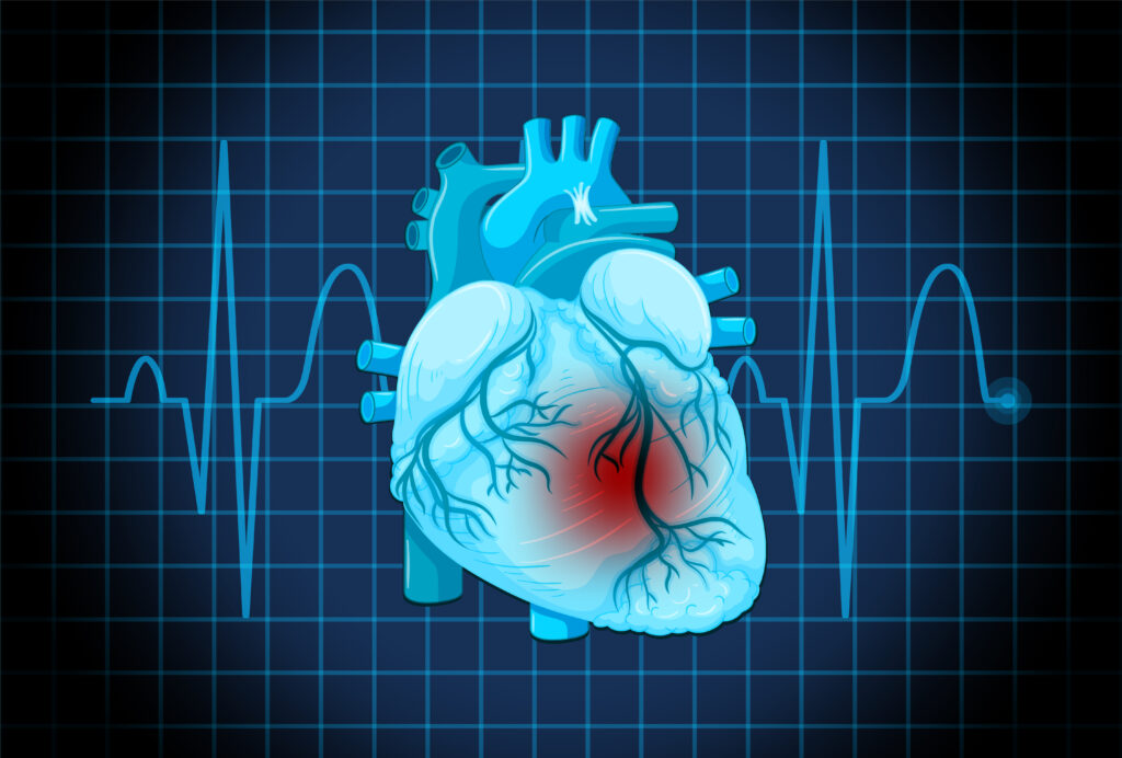 Heart Valve