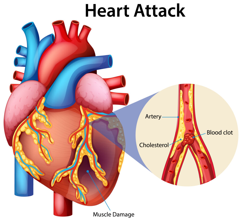 Heart Specialist