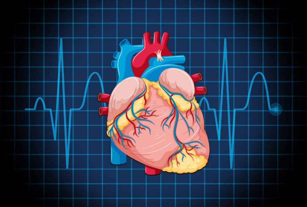 Heart Murmur