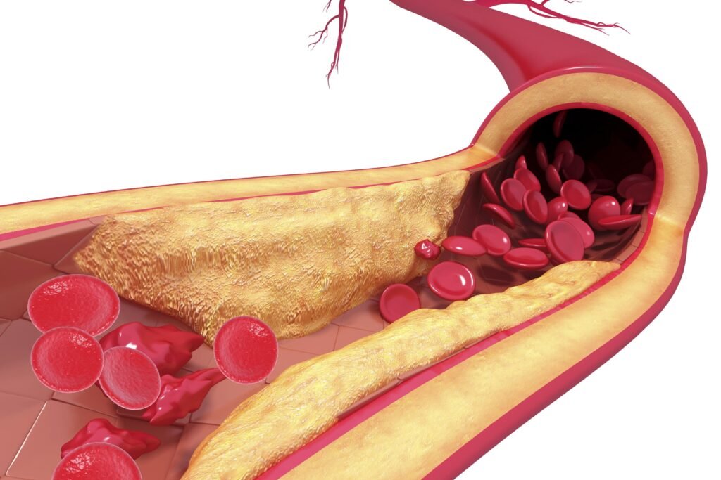 Arteries