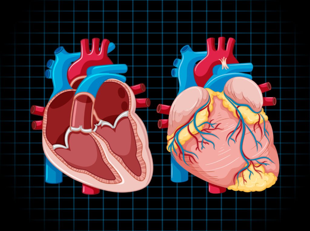 Heart Bypass