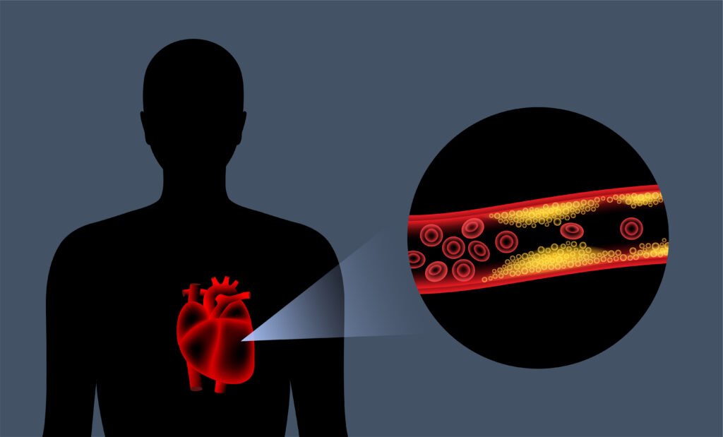 Arteries